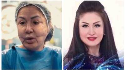 لعلاج التشوهات.. وفاء سالم تخضع لعملية تجميل جديدة