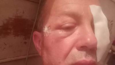 اصابة قائد قطار "شربين/ طنطا" بعد قذف الشباب للقطار بالحجارة